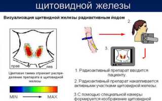 Суть метода сканирования щитовидной железы