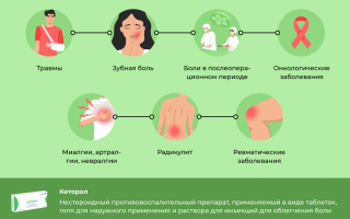 Обезболивающий препарат Кеторол – инструкция по применению и побочные эффекты