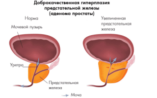 Как сделать красивый мейкап для круглых глаз