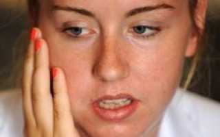 В каких случаях отечность после удаления зуба требует лечения?
