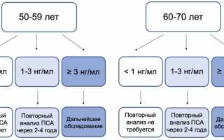 Понятие индекса здоровья простаты и его значение