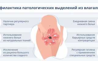 Причины и лечение появления выделений у женщин с неприятным запахом