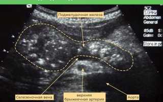 Что обозначает понятие «эхогенность поджелудочной железы»?