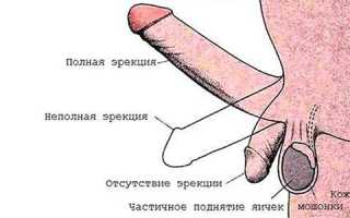 Причины и симптомы фиброза простаты