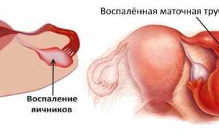 Причины задержки менструации на 5 дней при отрицательном тесте