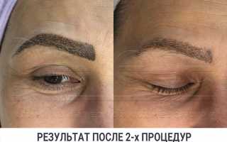 Как удалить татуаж и остаться с бровями?