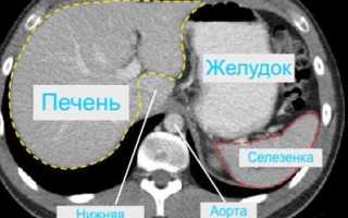 Компьютерная томография желудка: показания и особенности выполнения исследования