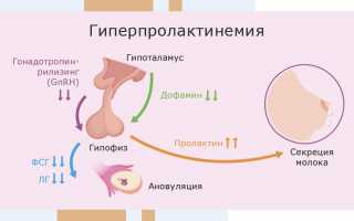 Причины и лечение отсутствия овуляции
