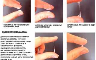 Лечение белых обильных выделений у женщин с запахом и без