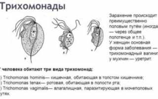 Трихомоноз: особенности заболевания