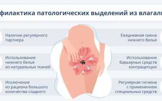 О чем свидетельствует появление желто-коричневых выделений и зуда у женщин