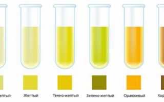 Почему от витаминов изменяется цвет мочи