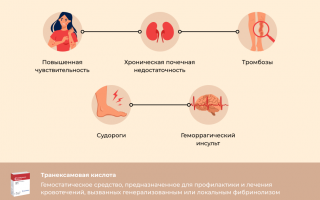 Применение Транексама при обильных месячных