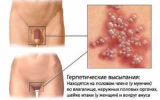 Темные пятна на мужском половом члене: причины