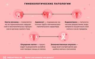 Почему возникают боли внизу живота в яичнике при овуляции?
