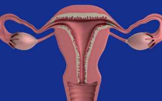 Неоднородный эндометрий: причины, симптомы и лечение