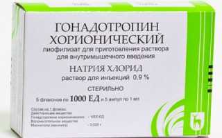 Укол ХГЧ для стимуляции овуляции и сравнение с другими методами