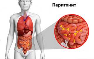 Характерные боли при панкреатите: причины и лечение