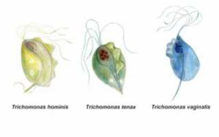 Кишечная трихомонада: строение, источник заражения, симптомы, диагностика, лечение