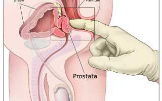 Определение расположения простаты: где находится предстательная железа у мужчин