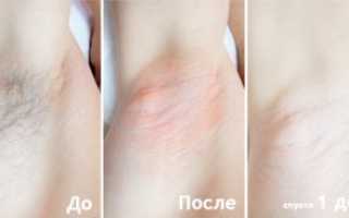 Правильный шугаринг подмышек: описание, техника выполнения и как сделать самостоятельно