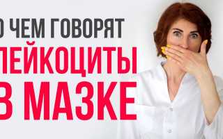 В мазке повышены лейкоциты: показатель нормы или патологии?