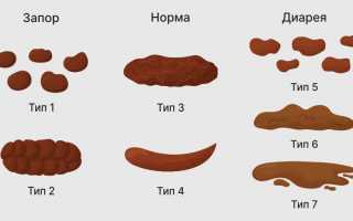 Описание Бристольской шкалы формы кала и её подробная расшифровка