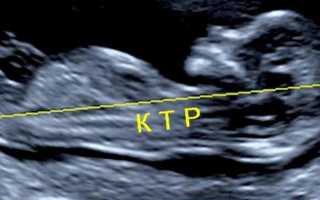 КТР или значение копчико-теменного размера по неделям беременности: какая норма, как измеряется показатель у плода?