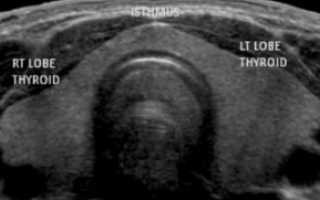 Какие показатели щитовидной железы на УЗИ являются нормальными?