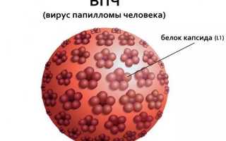 Папилломавирусная инфекция: последствия и лечение