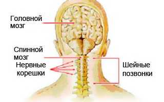 Выявляем и лечим шейную миелопатию