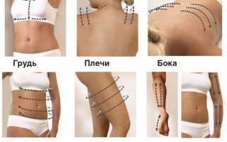 Как осуществлять массаж против целлюлита в домашних условиях?