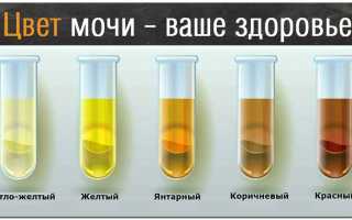 Нетипичный цвет мочи, рвоты или кала