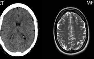 Разница между КТ и МРТ: какая томография лучше?